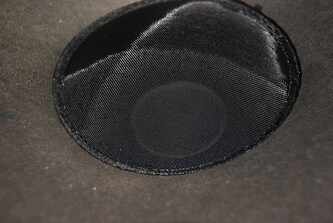 prior to procedure 3.jpg